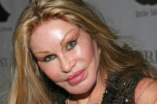 Jocelyn Wildenstein