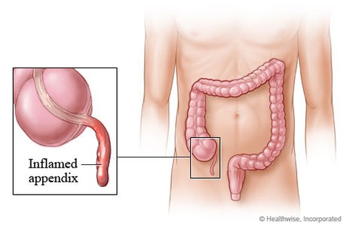 Appendix Useless Human Body Parts