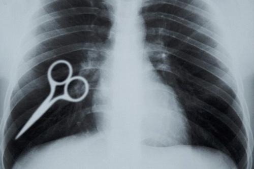 medical mistakes