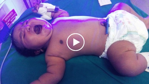 Teen delivers 15-pound baby in India