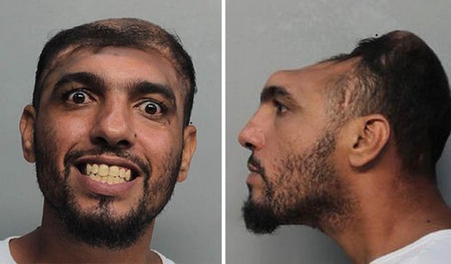 Man with half a head