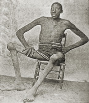 Top 10 Tallest Men