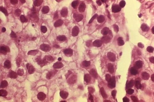 10 Urban Medical Legends