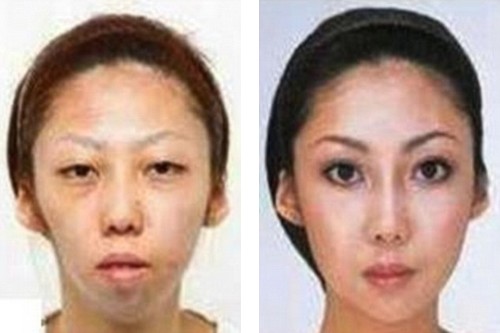 Before and after Jian Feng's wife
