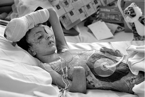 Disturbing Photographs Telling Tales Of Disaster