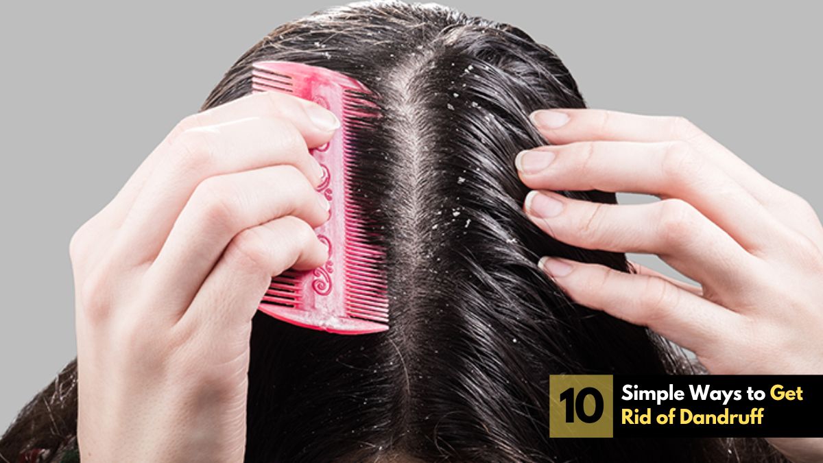 Simple Ways to Get Rid of Dandruff