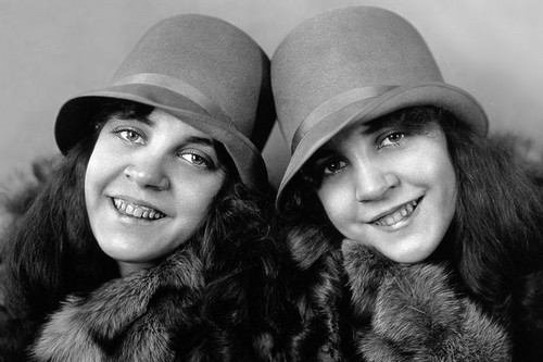 10 Most Fascinating Siamese Twins in History