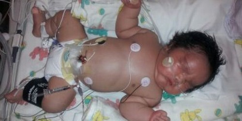 16-Pound Baby Born In California