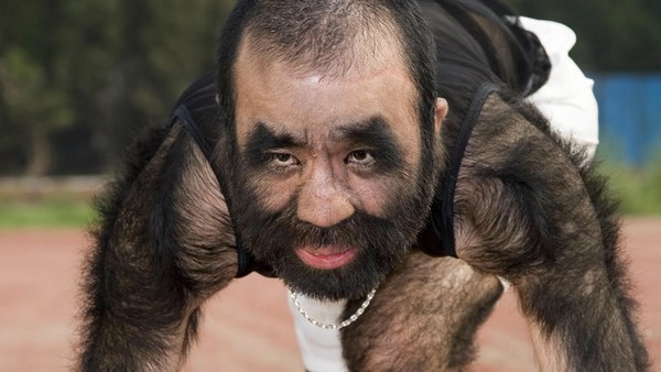 Hairiest Man On Earth