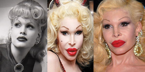 10 Times Plastic Surgery Went Horribly Wrong for Celebrities