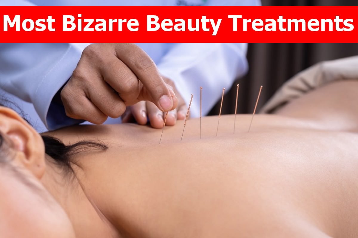 Top 10 Most Bizarre Beauty Treatments