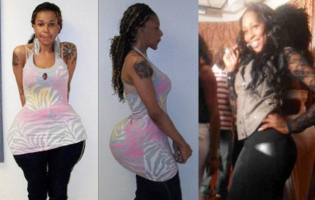 ake doctor boosted woman's bottom