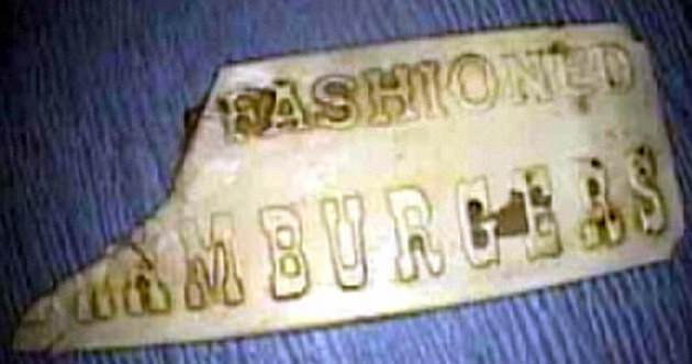 Shocking Things Found Inside Human Body