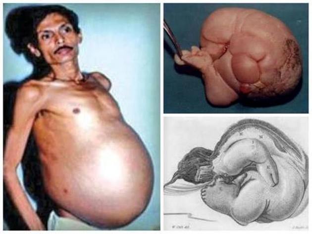 Shocking Things Found Inside Human Body