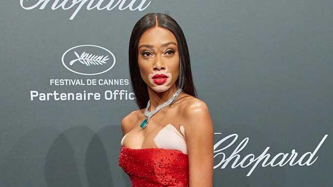 Winnie Harlow