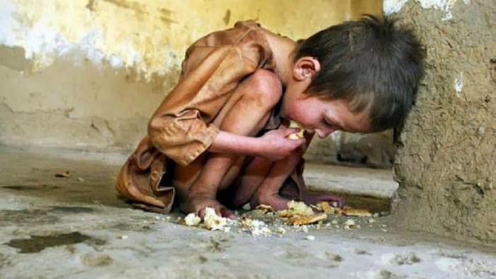 20,000 children die every day due to starvation