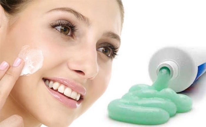 Get Rid of Acne by Toothpaste