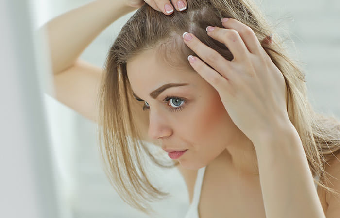 Ways to Control Hair Fall Naturally