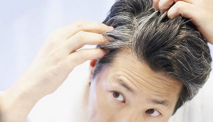 stop premature graying of hair