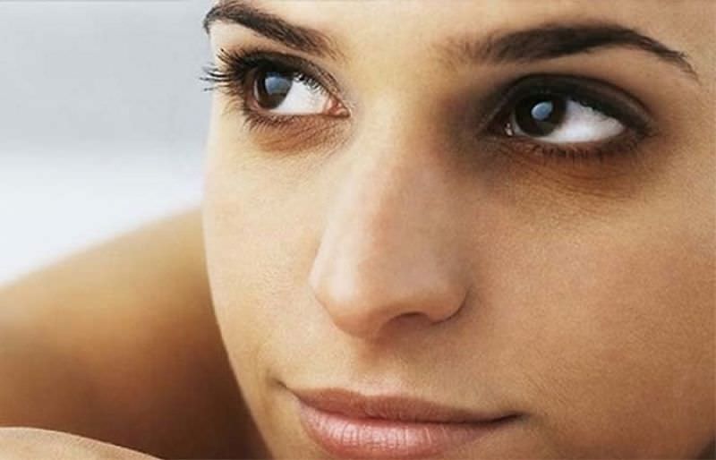 Dark Circles
