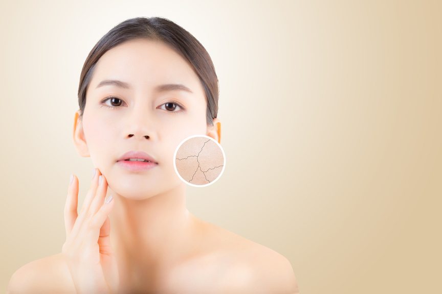 Dry Skin or Dehydration