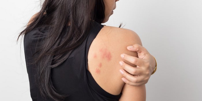 most common skin problems in India