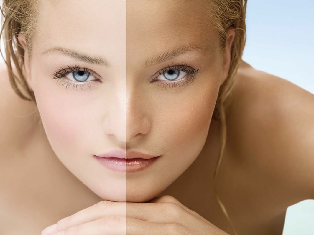 most common skin problems in India
