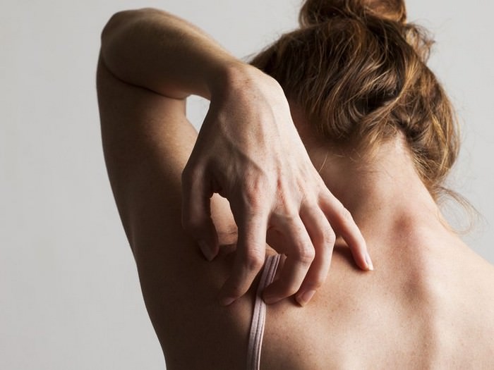 10 most common skin problems in India - WondersList